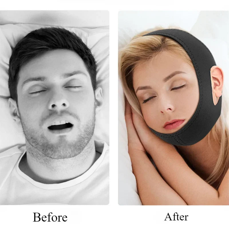 Anti Snore Chin Strap – Comfortable Night Sleeping Support for Men & Women